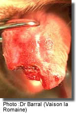 Nécrose de la langue Nécrose de la langue